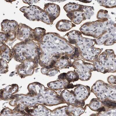 Immunohistochemistry-Paraffin: EVI5 Antibody [NBP1-82596] - Staining of human placenta shows moderate cytoplasmic positivity in trophoblastic cells.