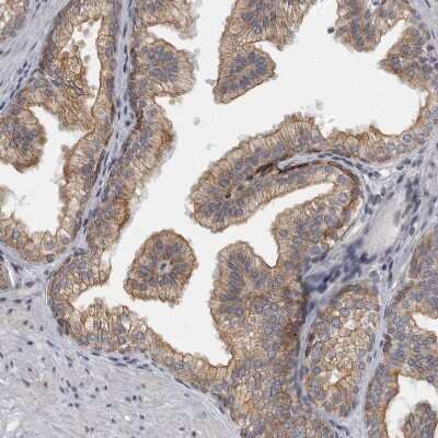 Immunohistochemistry-Paraffin: EVI5 Antibody [NBP1-82596] - Staining of human prostate shows moderate cytoplasmic positivity in glandular cells.