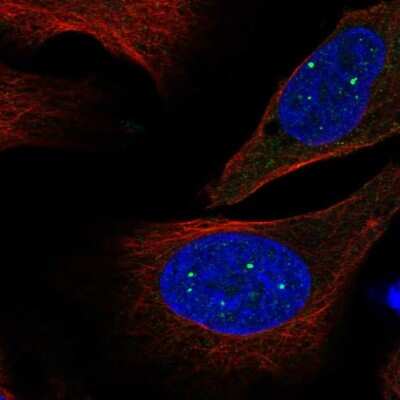 Immunocytochemistry/Immunofluorescence: EVI5L Antibody [NBP2-54925] - Staining of human cell line U-2 OS shows localization to nuclear bodies.