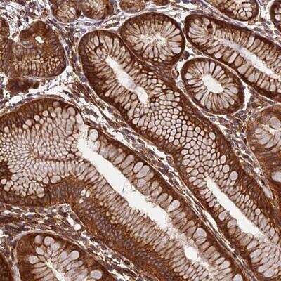 Immunohistochemistry-Paraffin EVI5L Antibody - BSA Free