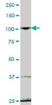 Western Blot EVI5L Antibody - Azide and BSA Free