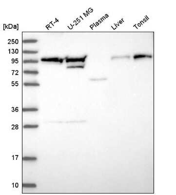 Western Blot EVI5L Antibody - BSA Free
