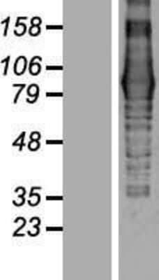 Western Blot: EVI5L Overexpression Lysate (Adult Normal) [NBP2-05489] Left-Empty vector transfected control cell lysate (HEK293 cell lysate); Right -Over-expression Lysate for EVI5L.
