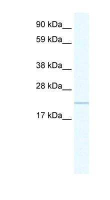 Western Blot: EVORF Antibody [NBP1-91609] - Human Placenta lysate, concentration 0.2-1 ug/ml.
