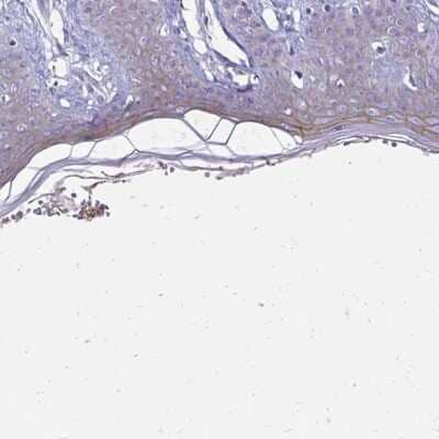 Immunohistochemistry-Paraffin: EVPL Antibody [NBP2-37940] - Staining of human skin shows high expression.