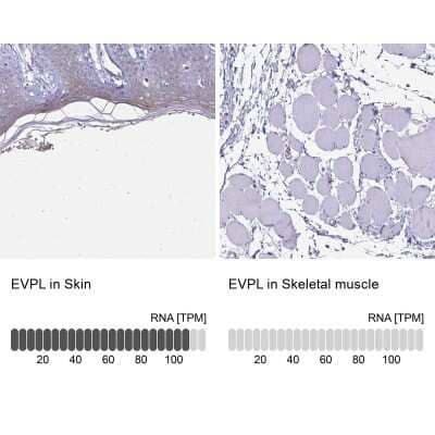 Immunohistochemistry-Paraffin: EVPL Antibody [NBP2-37940] - Staining in human skin and skeletal muscle tissues using anti-EVPL antibody. Corresponding EVPL RNA-seq data are presented for the same tissues.