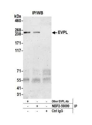 Immunoprecipitation: EVPL Antibody [NBP2-59099] - Detection of human EVPL by western blot of immunoprecipitates. Samples: Whole cell lysate (0.5 or 1.0 mg per IP reaction; 20% of IP loaded) from HeLa cells prepared using NETN lysis buffer. Antibodies: Affinity purified rabbit anti-EVPL antibody NBP2-59099 used for IP at 8 ul per reaction. EVPL was also immunoprecipitated by another rabbit anti-EVPL antibody. Detection: Chemiluminescence with an exposure time of 3 minutes.