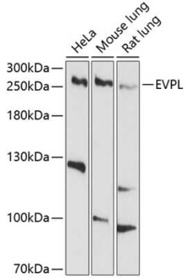 Western Blot: EVPL Antibody [NBP3-04791] - Analysis of extracts of various cell lines, using EVPL antibody at 1:1000 dilution. Secondary antibody: HRP Goat Anti-Rabbit IgG (H+L) at 1:10000 dilution. Lysates/proteins: 25ug per lane. Blocking buffer: 3% nonfat dry milk in TBST. Detection: ECL Basic Kit