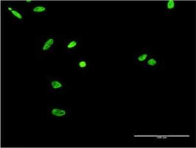 Immunocytochemistry/Immunofluorescence: EWSR1 Antibody (3A9) [H00002130-M02] - Analysis of monoclonal antibody to EWSR1 on HeLa cell . Antibody concentration 10 ug/ml.