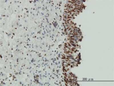 Immunohistochemistry-Paraffin: EWSR1 Antibody (5C10) [H00002130-M01] - Analysis of monoclonal antibody to EWSR1 on formalin-fixed paraffin-embedded human urinary bladder. Antibody concentration 3 ug/ml.