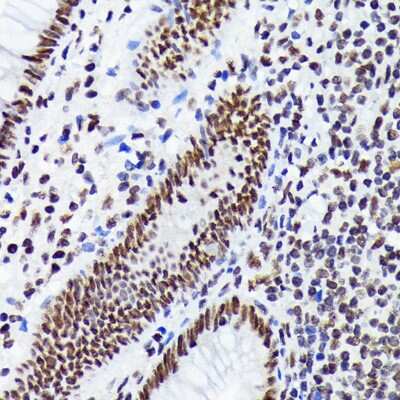 Immunohistochemistry-Paraffin: EWSR1 Antibody (9G3H1) [NBP3-16845] - Immunohistochemistry of paraffin-embedded human appendix using EWSR1 Rabbit mAb (NBP3-16845) at dilution of 1:100 (40x lens).Perform microwave antigen retrieval with 10 mM Tris/EDTA buffer pH 9.0 before commencing with IHC staining protocol.