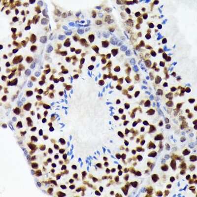 Immunohistochemistry-Paraffin: EWSR1 Antibody (9G3H1) [NBP3-16845] - Immunohistochemistry of paraffin-embedded mouse testis using EWSR1 Rabbit mAb (NBP3-16845) at dilution of 1:100 (40x lens).Perform microwave antigen retrieval with 10 mM Tris/EDTA buffer pH 9.0 before commencing with IHC staining protocol.