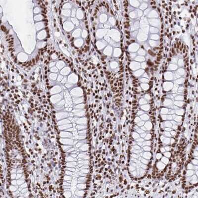 Immunohistochemistry: EWSR1 Antibody [NBP2-49380] - Staining of human colon shows strong nuclear positivity in glandular cells.