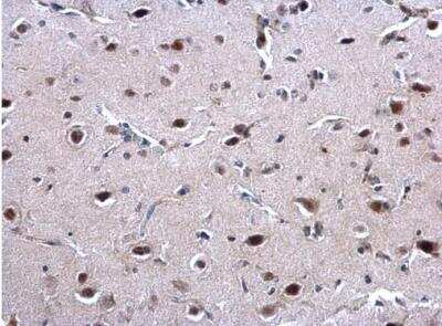 Immunohistochemistry-Paraffin: EWSR1 Antibody [NBP2-16389] - Paraffin-embedded rat fore brain.  EWSR1 antibody dilution: 1:500.