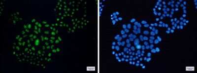 Immunocytochemistry/Immunofluorescence: EWSR1 Antibody (S09-3A7) [NBP3-14931] - Immunofluorescence of EWSR1 (green) in Hela cells using EWSR1 Rabbit mAb at dilution 1/50, and DAPI (blue)