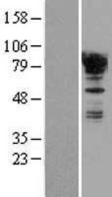 Western Blot EWSR1 Overexpression Lysate