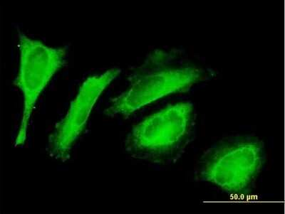 Immunocytochemistry/Immunofluorescence: EXD2 Antibody [H00055218-B01P] - Analysis of purified antibody to C14orf114 on HeLa cell. (antibody concentration 10 ug/ml)