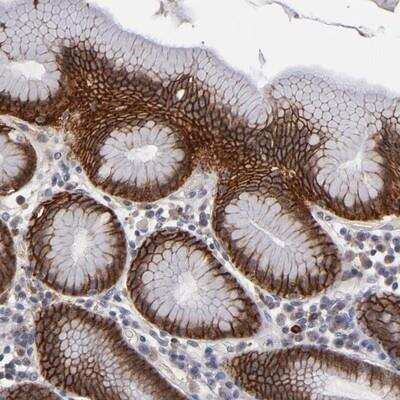 Immunohistochemistry: EXD2 Antibody [NBP1-88404] - Staining of human stomach shows strong cytoplasmic and membranous positivity in glandular cells.