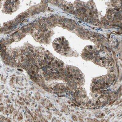 Immunohistochemistry-Paraffin: EXD2 Antibody [NBP1-88405] - Staining of human prostate shows moderate to strong nuclear and cytoplasmic postivity in glandular cells.