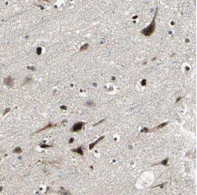 Immunohistochemistry-Paraffin: EXD2 Antibody [NBP1-88405] - Staining of human cerebral cortex shows strong nuclear and cytoplasmic positivity in neurons.
