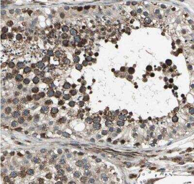 Immunohistochemistry-Paraffin: EXD2 Antibody [NBP1-88405] - Staining of human testis shows strong cytoplasmic postivity in cells in seminiferous ducts.