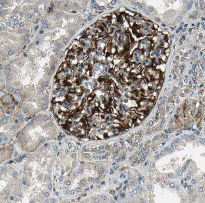 Immunohistochemistry-Paraffin: EXD2 Antibody [NBP1-88405] - Staining of human kidney shows strong cytoplasmic positivity in cells in glomeruli.