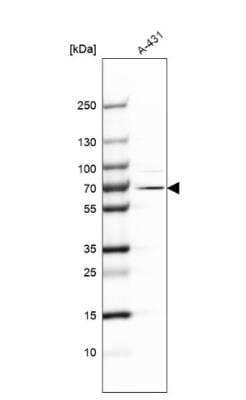 Western Blot: EXD2 Antibody [NBP1-88405] - Analysis in human cell line A-431.