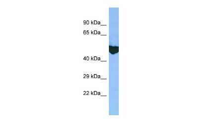 Western Blot: EXD2 Antibody [NBP2-87374] - Host: Rabbit. Target Name: EXD2. Sample Type: Placenta lysates. Antibody Dilution: 1.0ug/ml