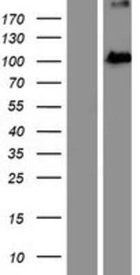 Western Blot: EXOC2 Overexpression Lysate (Adult Normal) [NBP2-06825] Left-Empty vector transfected control cell lysate (HEK293 cell lysate); Right -Over-expression Lysate for EXOC2.