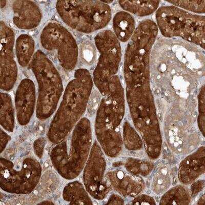 Immunohistochemistry-Paraffin: EXOC3L1 Antibody [NBP1-90471] - Staining of human kidney shows strong cytoplasmic positivity in cells in tubules.