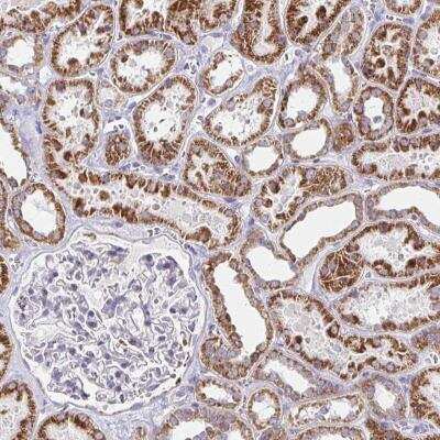 Immunohistochemistry-Paraffin EXOC5 Antibody