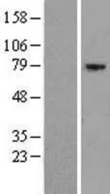 Western Blot: EXOC5 Overexpression Lysate (Adult Normal) [NBL1-10380] Left-Empty vector transfected control cell lysate (HEK293 cell lysate); Right -Over-expression Lysate for EXOC5.