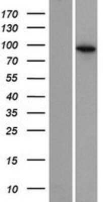 Western Blot: EXOC6B Overexpression Lysate [NBP2-10291] - Left-Empty vector transfected control cell lysate (HEK293 cell lysate); Right -Over-expression Lysate for EXOC6B.