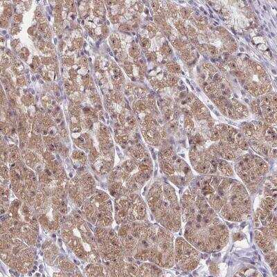 Immunohistochemistry-Paraffin EXOC6B Antibody