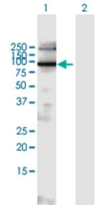 Western Blot EXOC6B Antibody