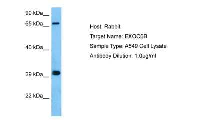 Western Blot: EXOC6B Antibody [NBP2-87378] - Host: Rabbit. Target Name: EXOC6B. Sample Tissue: Human A549 Whole Cell lysates. Antibody Dilution: 1ug/ml