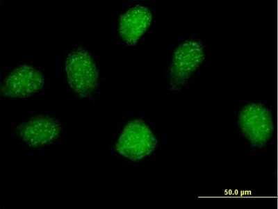 Immunocytochemistry/Immunofluorescence: EXOD1 Antibody [H00112479-B01P] - Analysis of purified antibody to MGC16943 on HeLa cell. (antibody concentration 10 ug/ml)