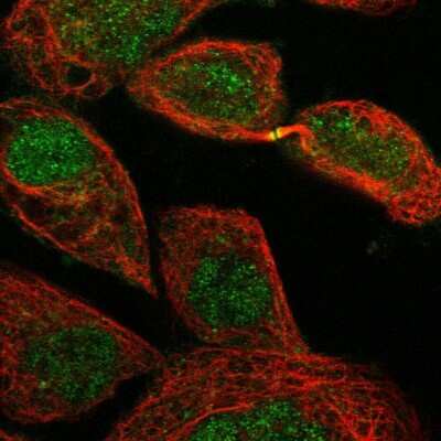 Immunocytochemistry/Immunofluorescence: EXOD1 Antibody [NBP1-87941] - Immunofluorescent staining of human cell line A-431 shows localization to nucleus & cytokinetic bridge.