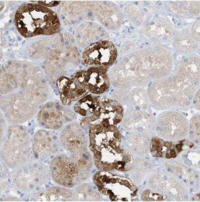 Immunohistochemistry: EXOD1 Antibody [NBP2-34000] - Staining of human kidney shows strong cytoplasmic and nuclear positivity in distal tubules.