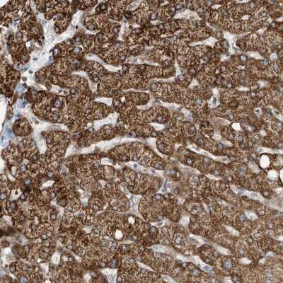 Immunohistochemistry-Paraffin: EXOD1 Antibody [NBP1-87941] - Staining of human liver shows strong cytoplasmic positivity in hepatocytes.