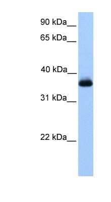 Western Blot: EXOD1 Antibody [NBP1-55303] - Jurkat cell lysate, concentration 0.2-1 ug/ml.