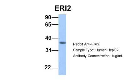 Western Blot: EXOD1 Antibody [NBP1-55303] - Human HepG2, Antibody Dilution: 1.0 ug/ml ERI2 is supported by BioGPS gene expression data to be expressed in HepG2.