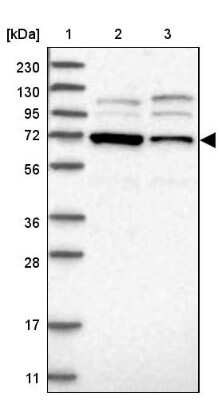 Western Blot: EXOD1 Antibody [NBP1-87941] - Lane 1: Marker [kDa] 230, 130, 95, 72, 56, 36, 28, 17, 11Lane 2: Human cell line RT-4Lane 3: Human cell line U-251MG sp