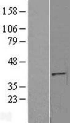 Western Blot: EXOD1 Overexpression Lysate (Adult Normal) [NBL1-10382] Left-Empty vector transfected control cell lysate (HEK293 cell lysate); Right -Over-expression Lysate for EXOD1.