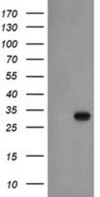 Western Blot: EXOSC3 Antibody (1D6) [NBP2-02070] HEK293T cells were transfected with the pCMV6-ENTRY control (Left lane) or pCMV6-ENTRY EXOSC3 (Right lane) cDNA for 48 hrs and lysed. Equivalent amounts of cell lysates (5 ug per lane) were separated by SDS-PAGE and immunoblotted with anti-EXOSC3.