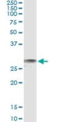 Immunoprecipitation: EXOSC3 Antibody (3E5) [H00051010-M11] - Analysis of EXOSC3 transfected lysate using anti-EXOSC3 monoclonal antibody and Protein A Magnetic Bead, and immunoblotted with EXOSC3 rabbit polyclonal antibody.