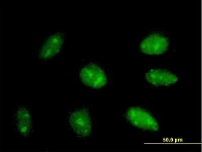 Immunocytochemistry/Immunofluorescence: EXOSC3 Antibody [H00051010-B01P] - Analysis of purified antibody to EXOSC3 on HepG2 cell. (antibody concentration 10 ug/ml)