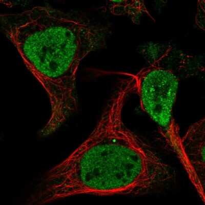 Immunocytochemistry/ Immunofluorescence EXOSC3 Antibody