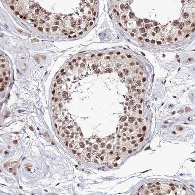 Immunohistochemistry-Paraffin: EXOSC3 Antibody [NBP1-91874] - Staining of human testis shows strong nuclear positivity in cells in seminiferous ducts.