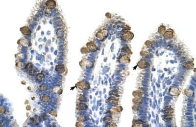 Immunohistochemistry-Paraffin: EXOSC3 Antibody [NBP1-57209] - Human Intestine Tissue, antibody concentration 4-8ug/ml. Cells with positive label: Epithelial cells of intestinal villus (indicated with arrows) 400X magnification.